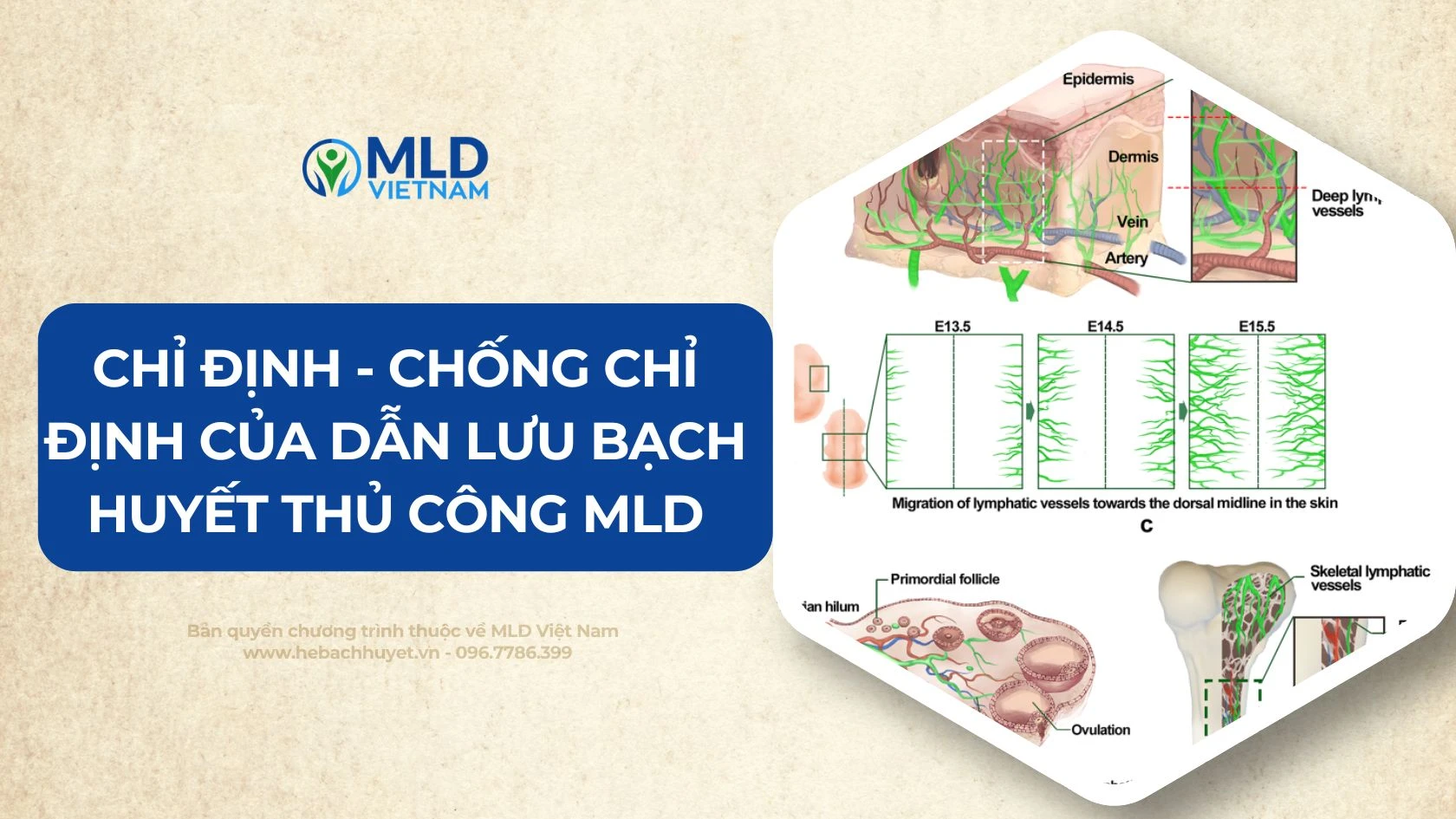 Ứng dụng và chỉ định lâm sàng của Dẫn lưu bạch huyết